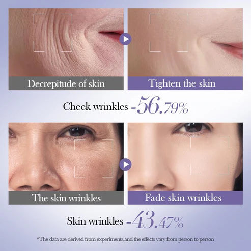Bioaqua Retinol Skin Care Set (Original) | Anti-Aging, Wrinkle & Dark Spot Treatment